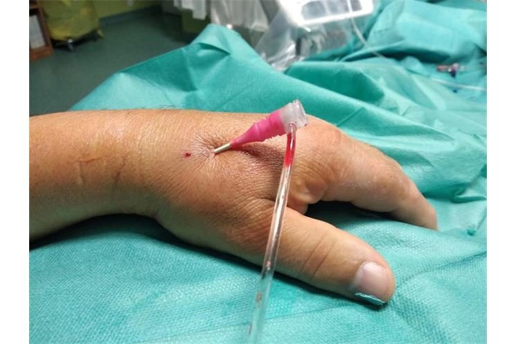 TZ Kardiologie-nova metoda TZ Kardiologie-nova metoda