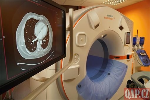 nové CT FN Plzeň_0125_QAP (6)